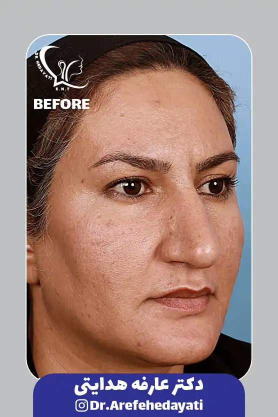 قبل نمونه کار دکتر عارفه هدایتی 1