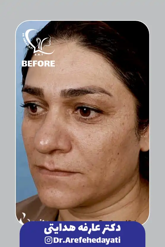 قبل نمونه کار دکتر عارفه هدایتی 10
