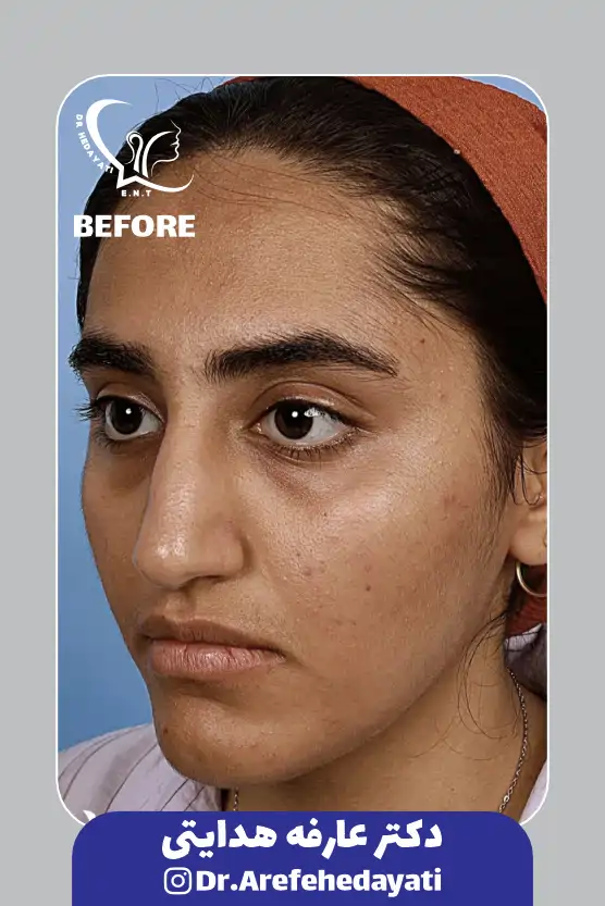 قبل نمونه کار دکتر عارفه هدایتی 5