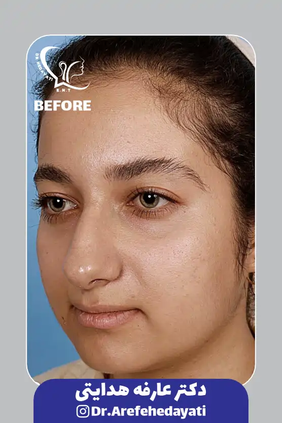 قبل نمونه کار دکتر عارفه هدایتی 6