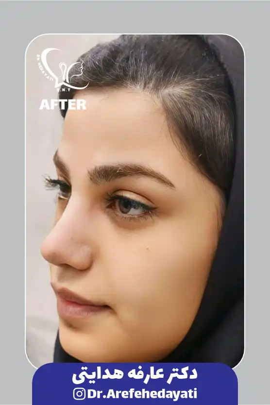 بعد نمونه کار دکتر عارفه هدایتی13