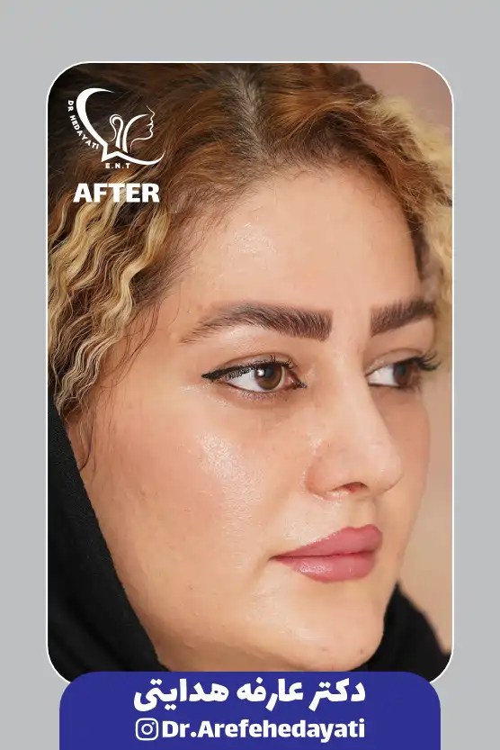 بعد نمونه کار دکتر عارفه هدایتی16