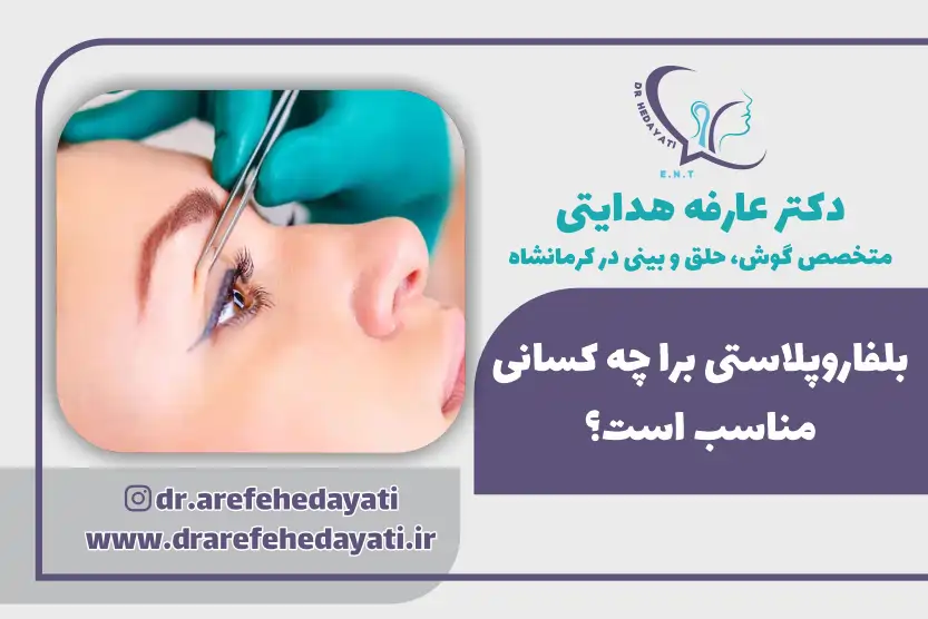 بلفاروپلاستی برای چه کسانی مناسب است
