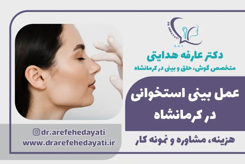 بهترین جراح بینی استخوانی کرمانشاه