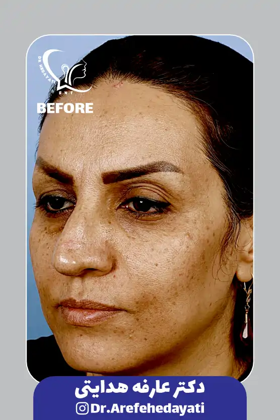 قبل نمونه کار دکتر عارفه هدایتی12