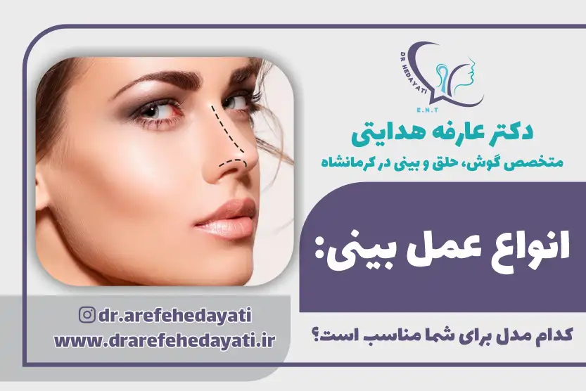 بررسی انواع عمل بینی