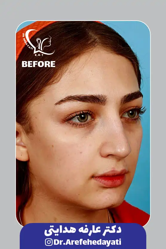 نمونه کار قبل 1