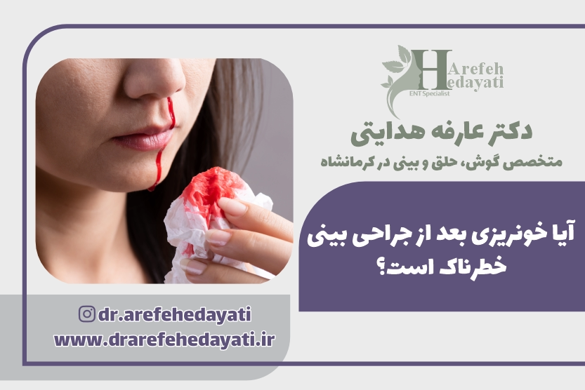 آیا خونریزی بعد از جراحی بینی خطرناک است؟