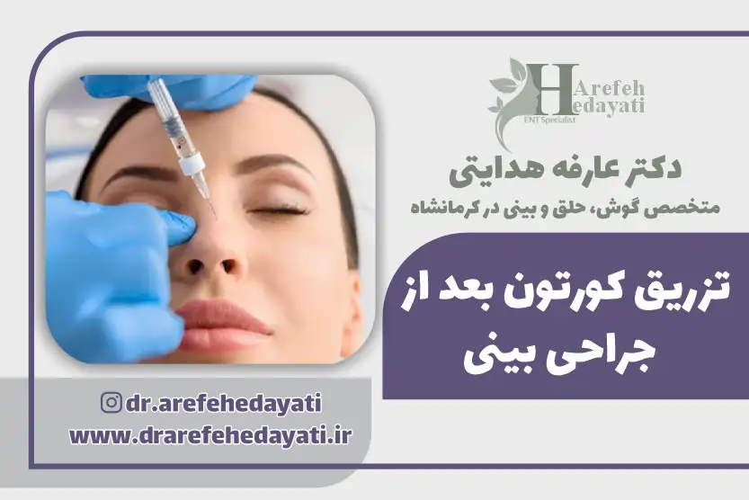 تزریق کورتون بعد از جراحی بینی