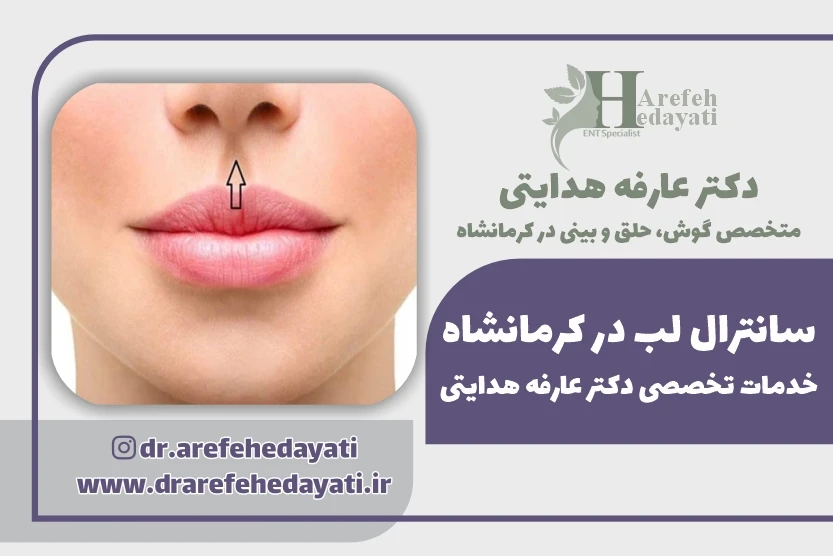 سانترال لب در کرمانشاه خدمات تخصصی دکتر عارفه هدایتی