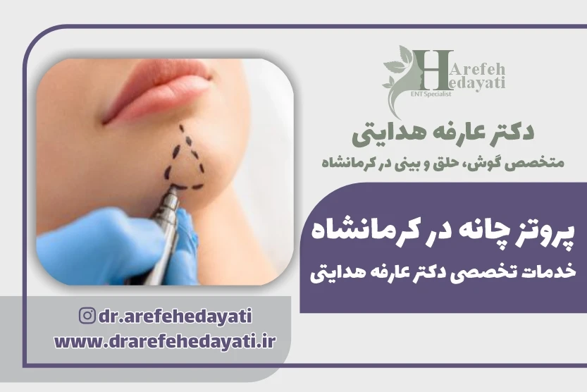 پروتز چانه در کرمانشاه خدمات تخصصی دکتر عارفه هدایتی