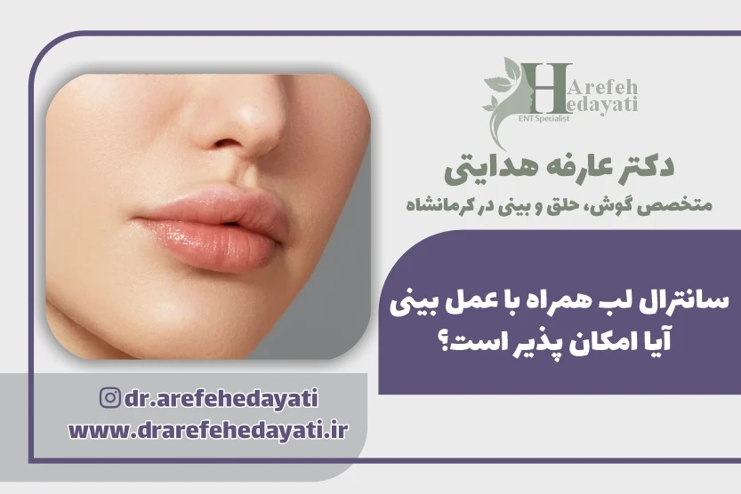 سانترال لب همراه با عمل بینی آیا امکان پذیر است؟