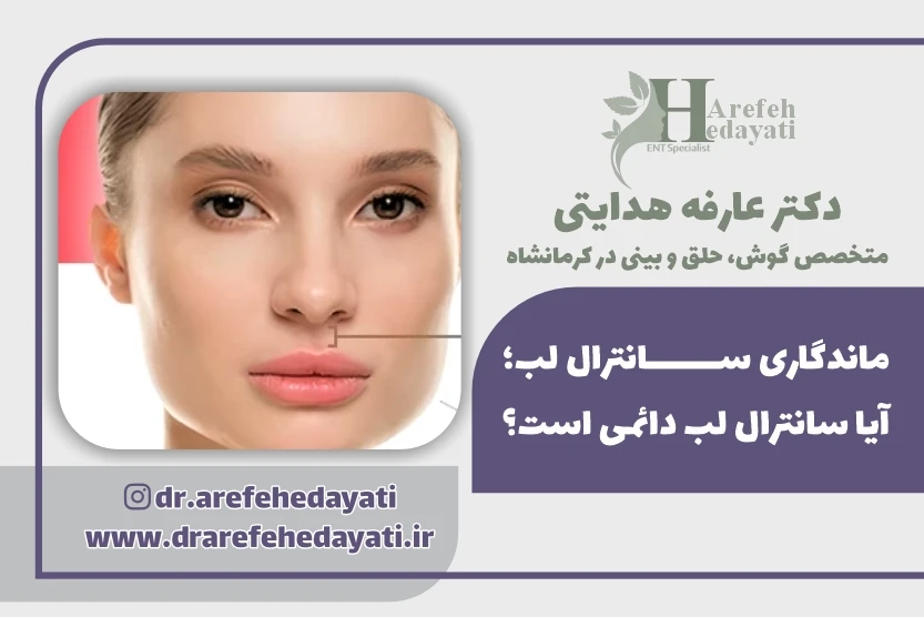 ماندگاری سانترال لب آیا سانترال لب دائمی است؟