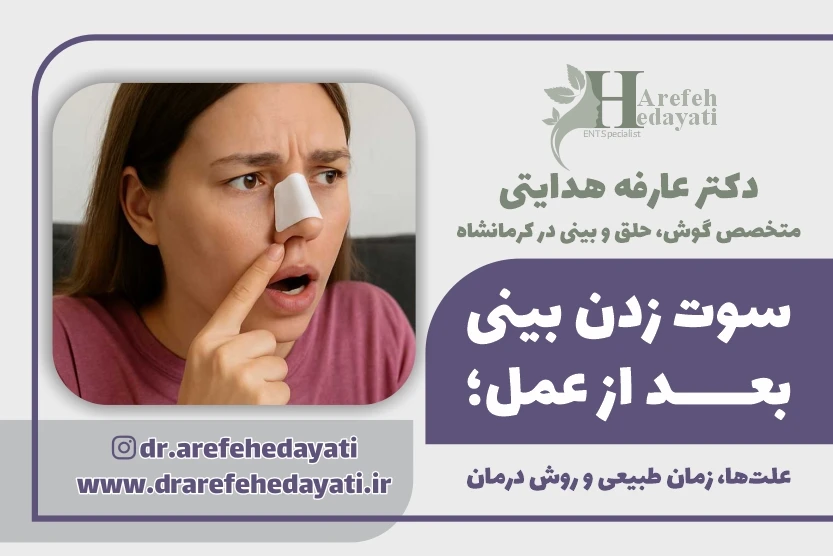 سوت زدن بینی بعد از عمل علت_ها، زمان طبیعی و روش درمان