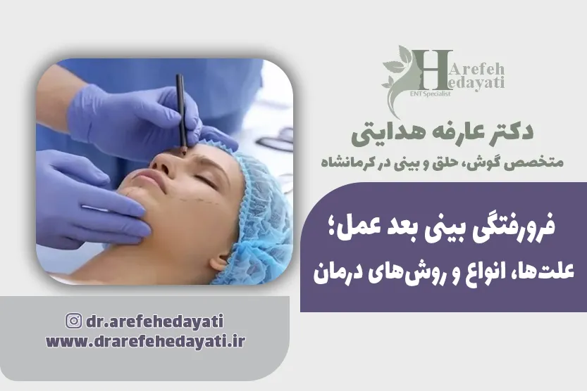 فرورفتگی بینی بعد عمل؛ علت_ها، انواع و روش_های درمان