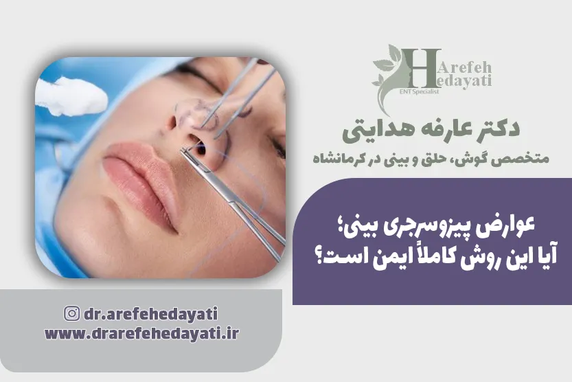 عوارض پیزوسرجری بینی؛ آیا این روش کاملاً ایمن است؟